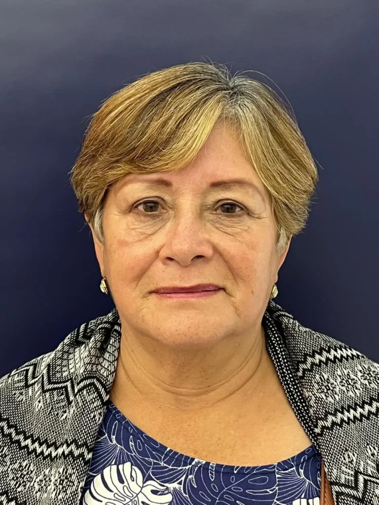 Blefaroplastia Caso 1 Antes