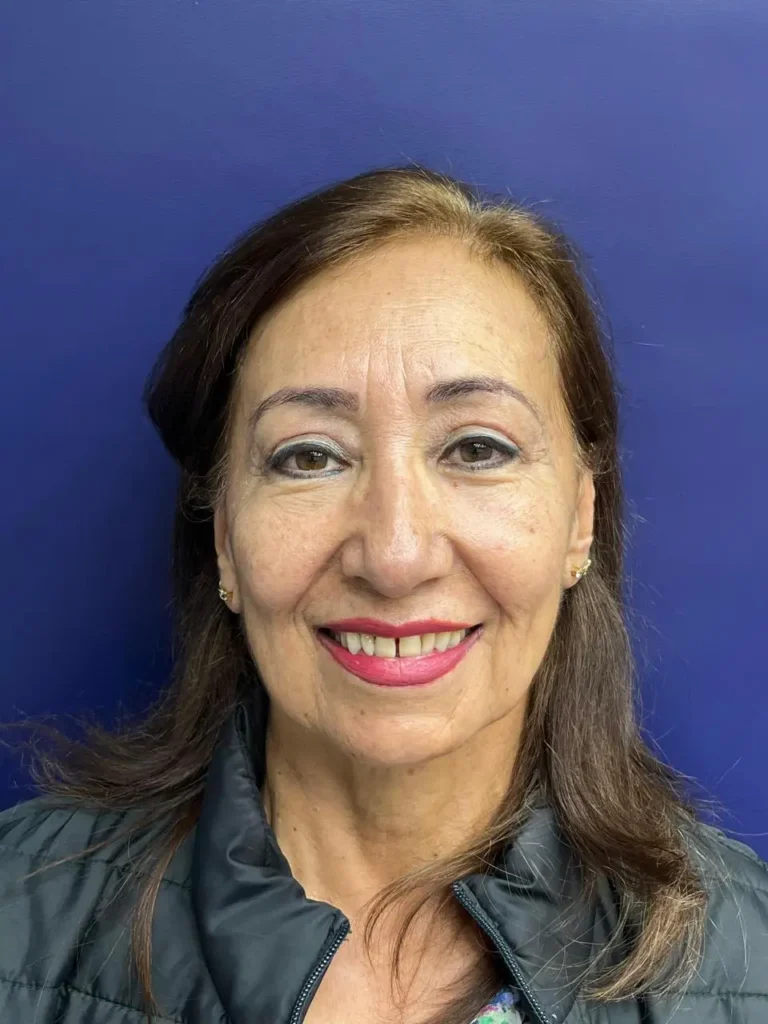 Blefaroplastia Caso 2 Después