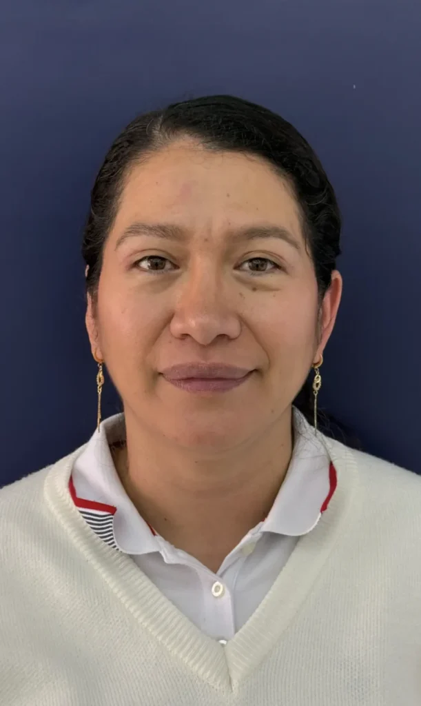 Blefaroplastia Caso 3 Resultado 1